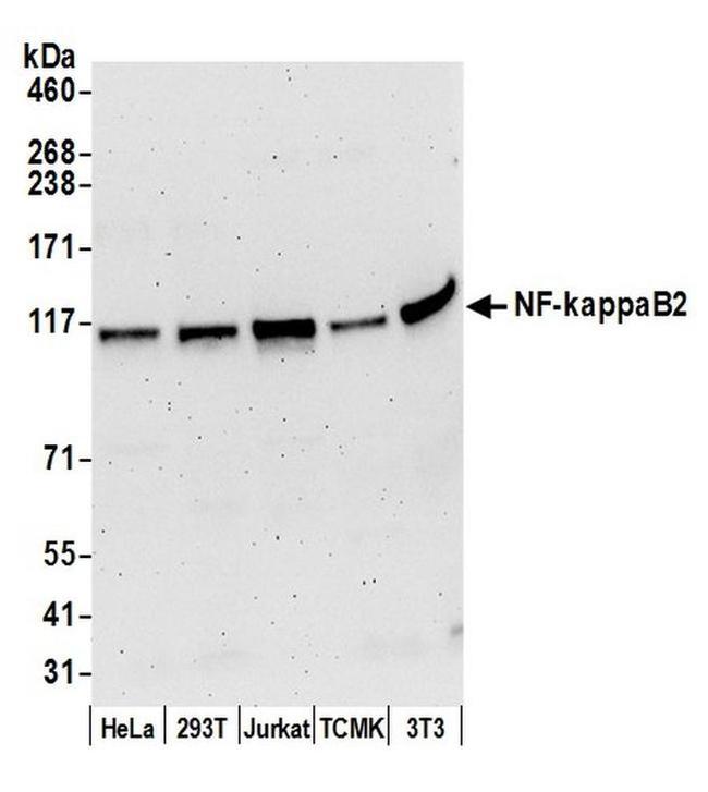 NF-kappaB2 Antibody in Western Blot (WB)