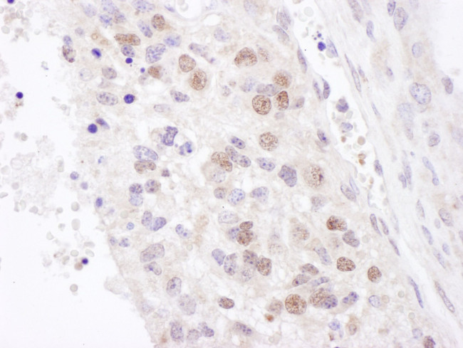 NF90/NF110 Antibody in Immunohistochemistry (IHC)