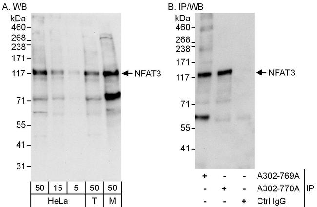 NFAT3 Antibody in Western Blot (WB)