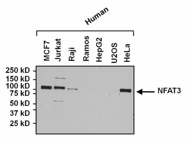 NFATC4 Antibody in Western Blot (WB)