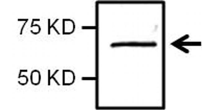 NFkB p65 Antibody in Western Blot (WB)