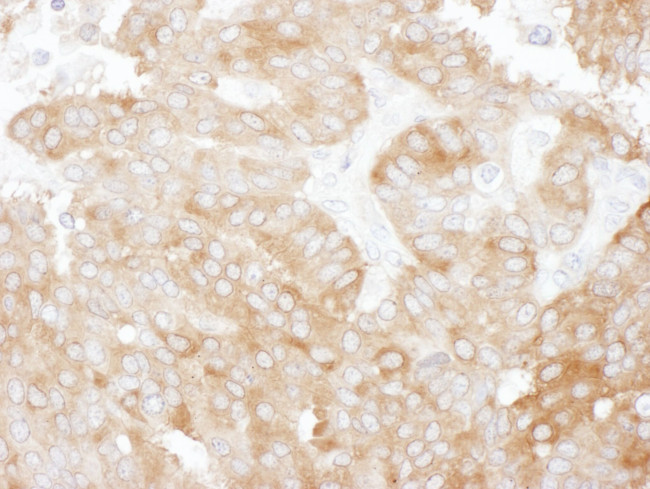 NHERF1 Antibody in Immunohistochemistry (IHC)