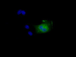 NIT2 Antibody in Immunocytochemistry (ICC/IF)