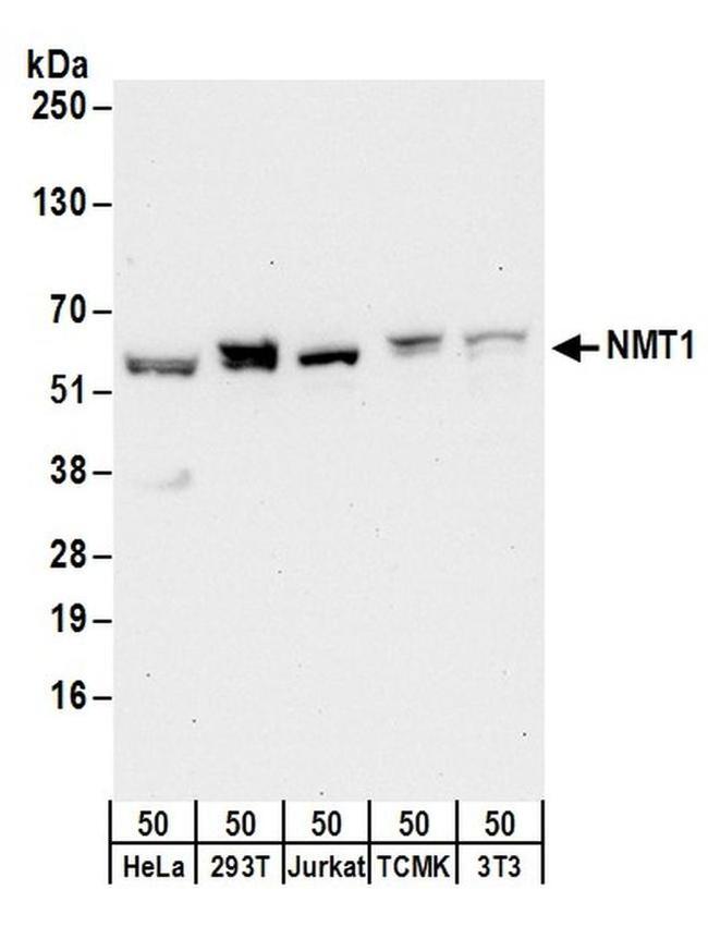 NMT1 Antibody in Western Blot (WB)