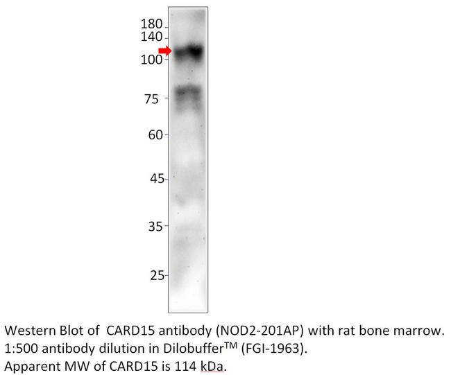 CARD15 Antibody in Western Blot (WB)