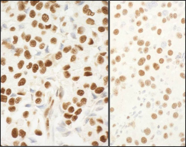 NPM1 Antibody in Immunohistochemistry (IHC)