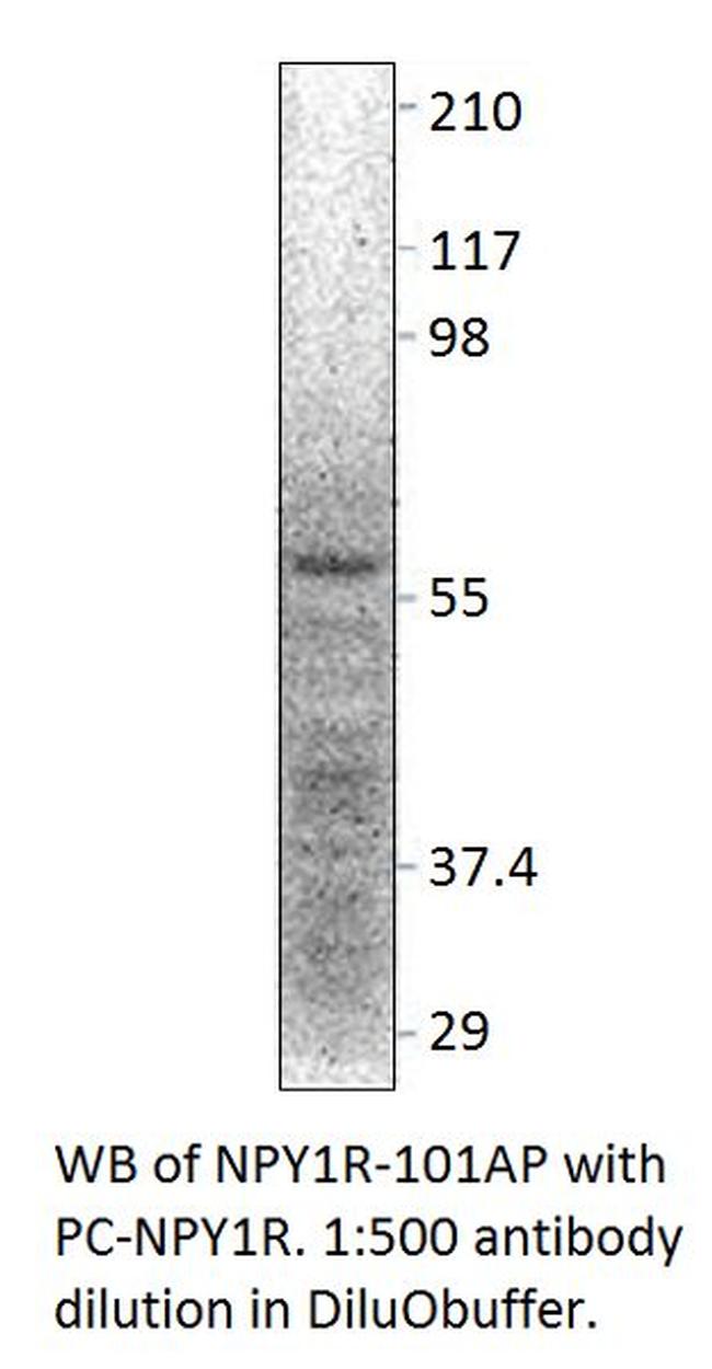 NPY1R Antibody in Western Blot (WB)