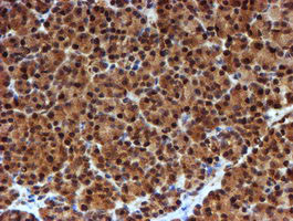 NQO2 Antibody in Immunohistochemistry (Paraffin) (IHC (P))