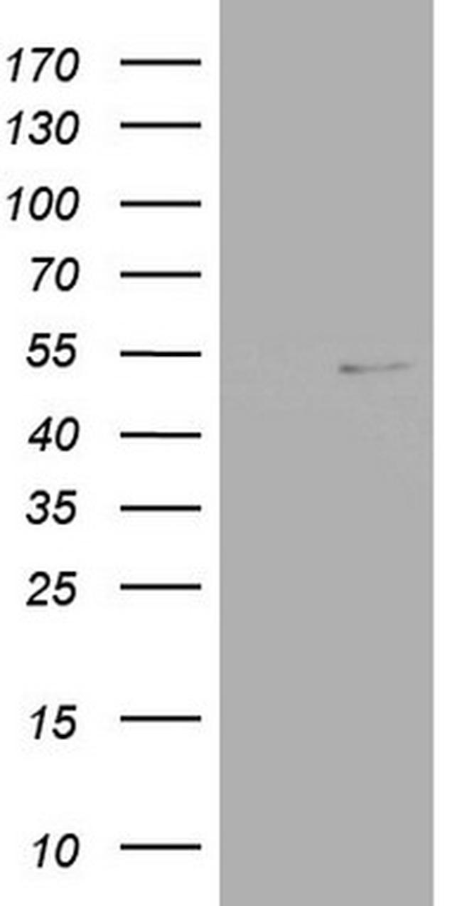 NR2C1 Antibody in Western Blot (WB)