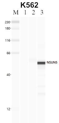 NSUN5 Antibody in Immunoprecipitation (IP)