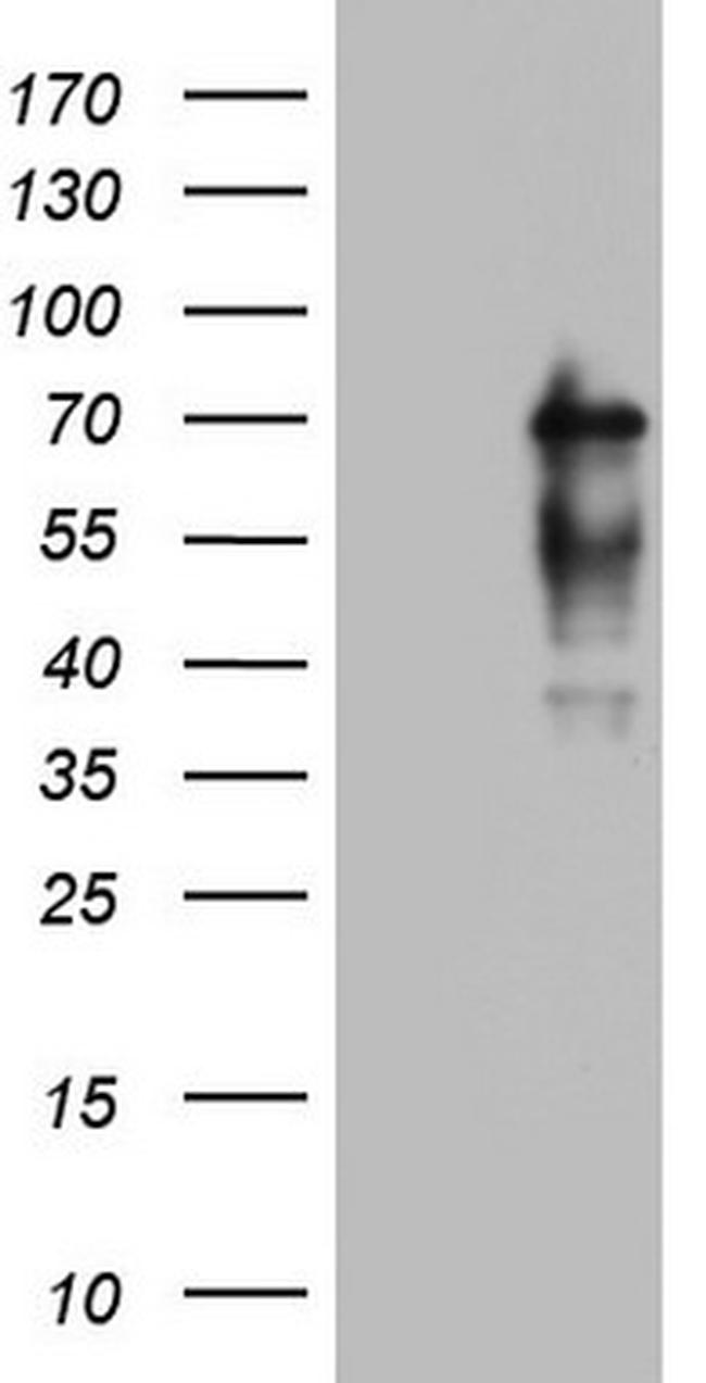 NUMB Antibody in Western Blot (WB)