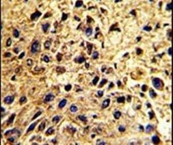 NUP62 Antibody in Immunohistochemistry (IHC)