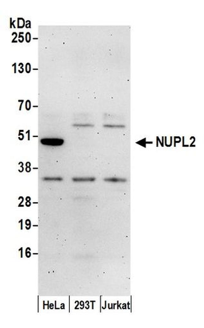 NUPL2 Antibody in Western Blot (WB)