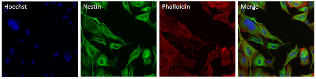 Nestin Antibody in Immunocytochemistry (ICC/IF)