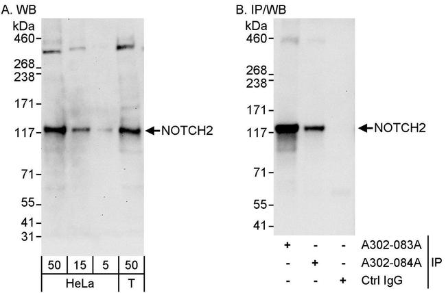 Notch2 Antibody in Western Blot (WB)