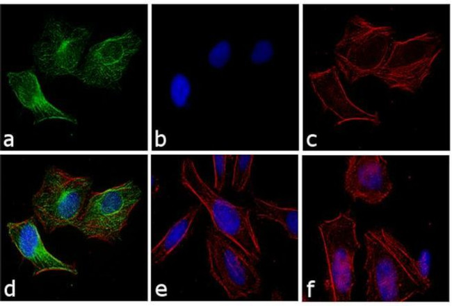 Rabbit IgG (H+L) Highly Cross-Adsorbed Secondary Antibody in Immunocytochemistry (ICC/IF)