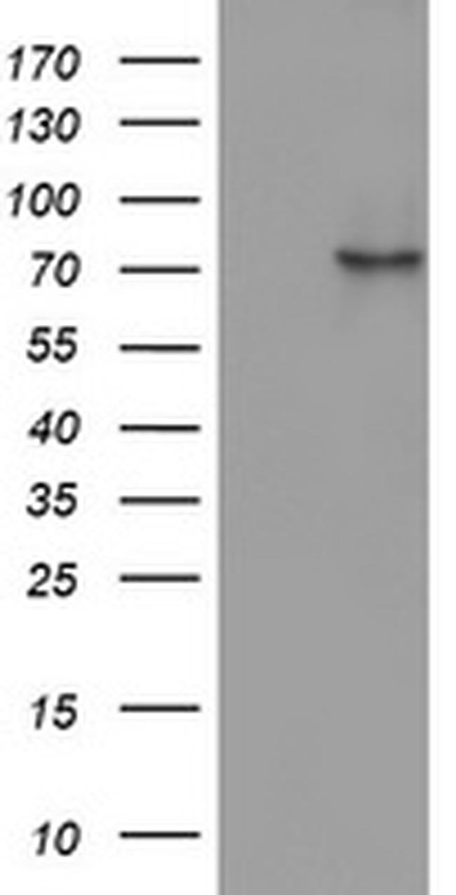 OAS2 Antibody in Western Blot (WB)