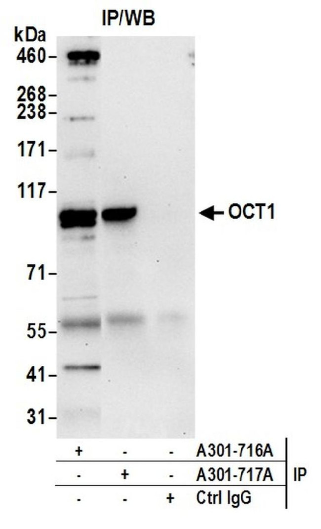 OCT1 Antibody in Immunoprecipitation (IP)