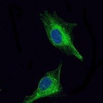 OLIG2 Antibody in Immunocytochemistry (ICC/IF)