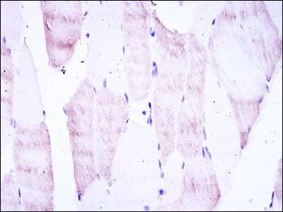 OLIG2 Antibody in Immunohistochemistry (Paraffin) (IHC (P))