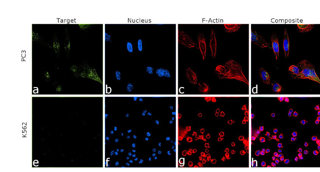 Amyloid Precursor Protein Antibody in Immunocytochemistry (ICC/IF)