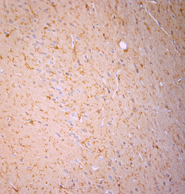 Cofilin 1 Antibody in Immunohistochemistry (Paraffin) (IHC (P))