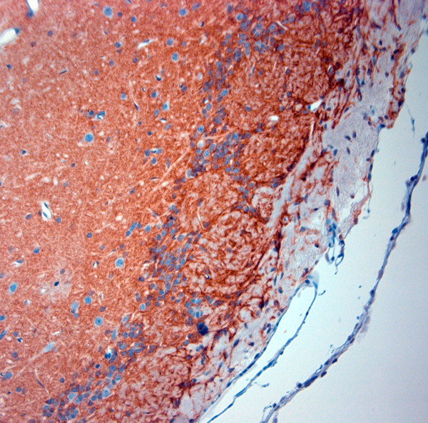 SLC1A2 Antibody in Immunohistochemistry (Paraffin) (IHC (P))