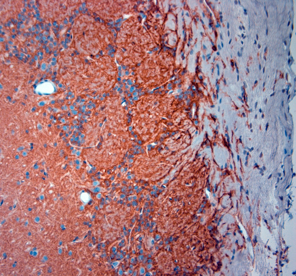 SLC1A2 Antibody in Immunohistochemistry (Paraffin) (IHC (P))