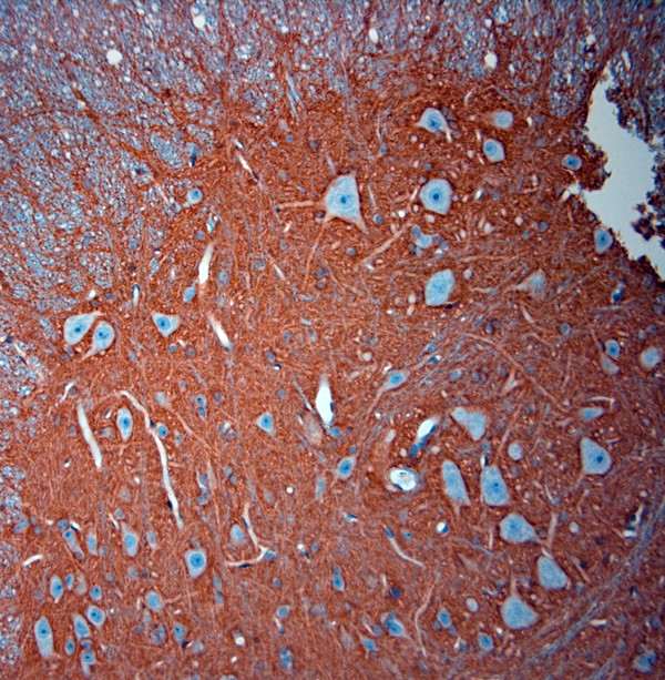 SLC1A2 Antibody in Immunohistochemistry (Paraffin) (IHC (P))