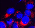 TRPM7 Antibody in Immunocytochemistry (ICC/IF)