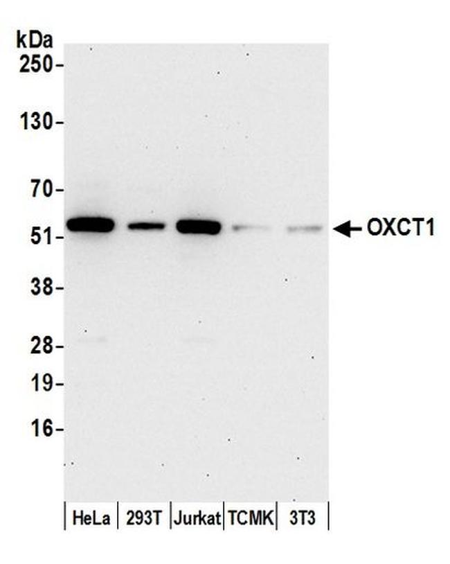 OXCT1 Antibody in Western Blot (WB)