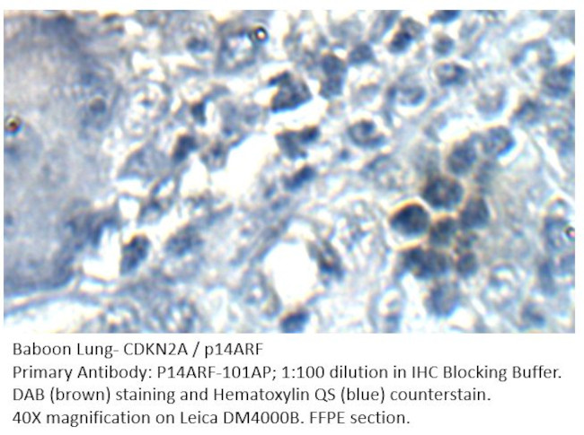 CDKN2A/p14ARF Antibody in Immunohistochemistry (IHC)