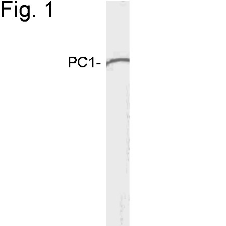 PCSK1 Antibody in Western Blot (WB)