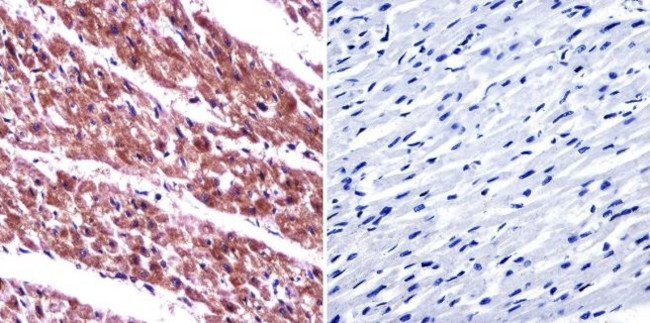 ARF6 Antibody in Immunohistochemistry (Paraffin) (IHC (P))