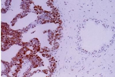 APE1 Antibody in Immunohistochemistry (Paraffin) (IHC (P))