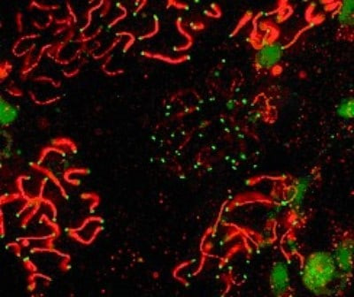 SCP1 Antibody in Immunocytochemistry (ICC/IF)