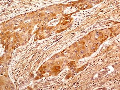 beta Tubulin Antibody in Immunohistochemistry (Paraffin) (IHC (P))