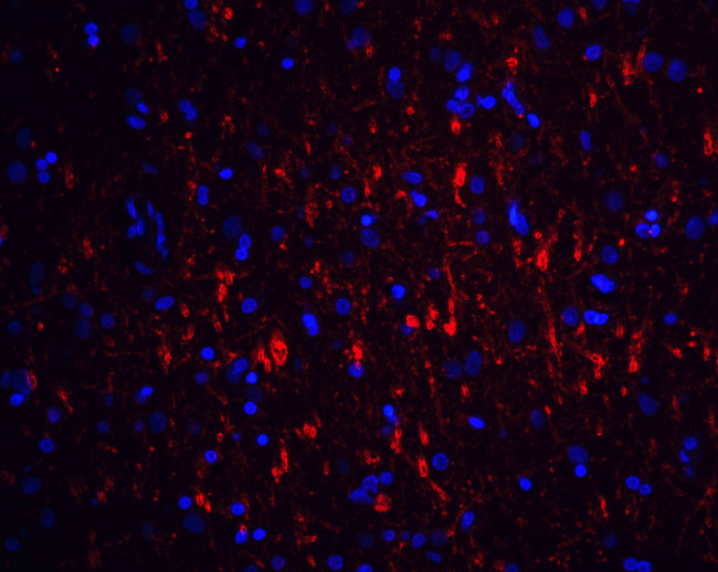 GFR alpha-1 Antibody in Immunohistochemistry (Paraffin) (IHC (P))