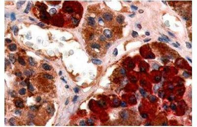 GHRHR Antibody in Immunohistochemistry (Paraffin) (IHC (P))