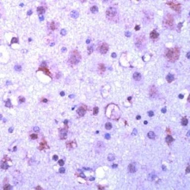 GSK3 alpha/beta Antibody in Immunohistochemistry (IHC)