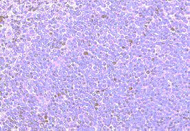 CCRD6 Antibody in Immunohistochemistry (Paraffin) (IHC (P))