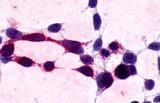 XPR1 Antibody in Immunocytochemistry (ICC/IF)