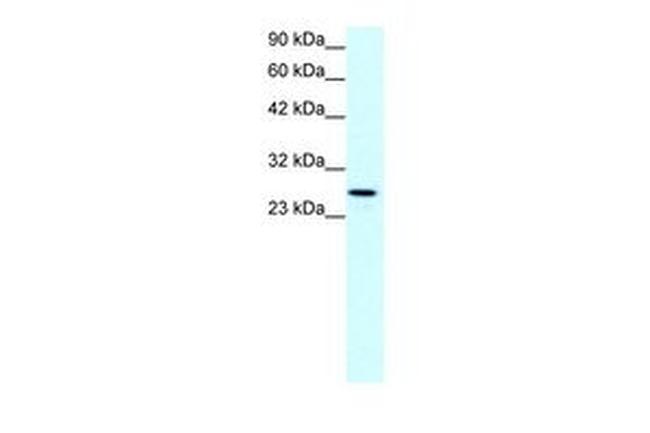 Claudin 13 Antibody in Western Blot (WB)