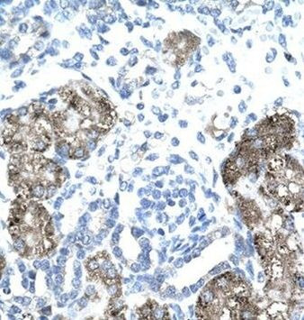 GTF2H1 Antibody in Immunohistochemistry (IHC)