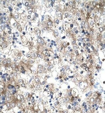 GTF2H1 Antibody in Immunohistochemistry (IHC)