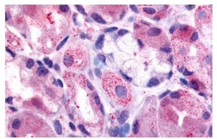 HRH2 Antibody in Immunohistochemistry (Paraffin) (IHC (P))