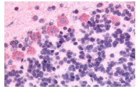 GPR89A Antibody in Immunohistochemistry (Paraffin) (IHC (P))