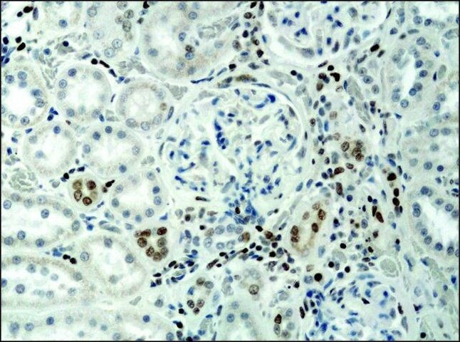 H3K9acS10ph Antibody in Immunohistochemistry (Paraffin) (IHC (P))