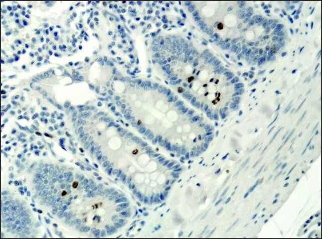 H3K9acS10ph Antibody in Immunohistochemistry (Paraffin) (IHC (P))