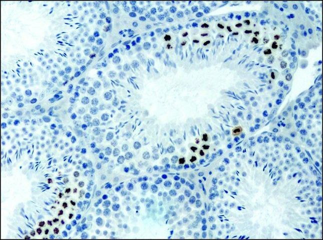 H3K9acS10ph Antibody in Immunohistochemistry (Paraffin) (IHC (P))